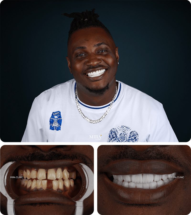 Преображение 1