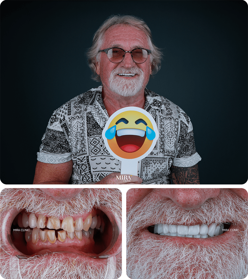 Преображение 3