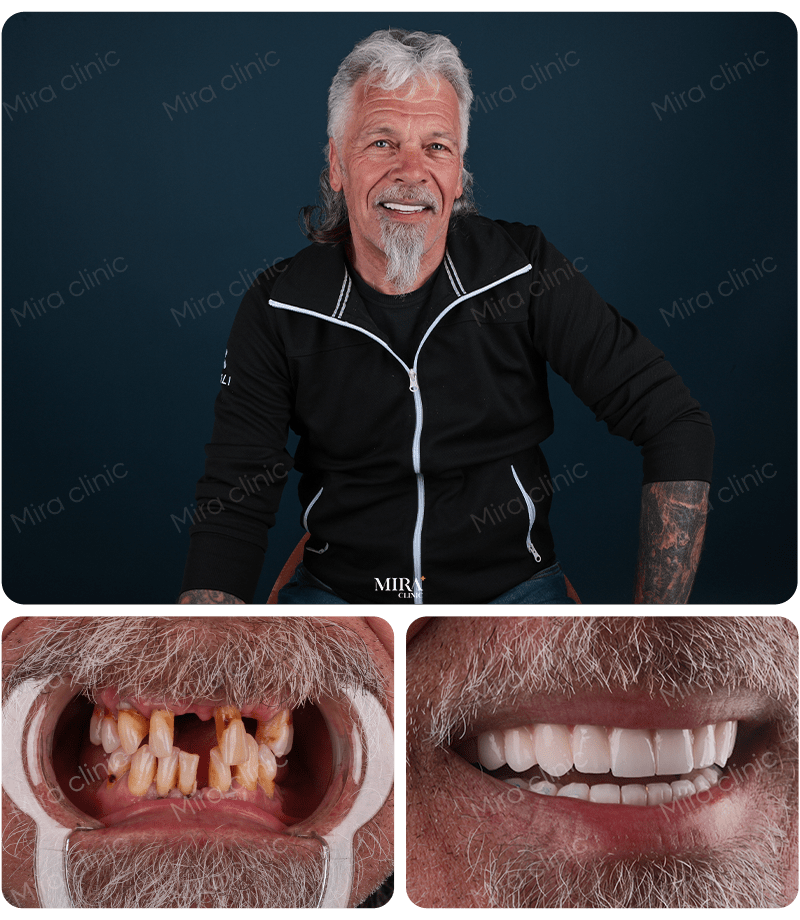 Преображение 4