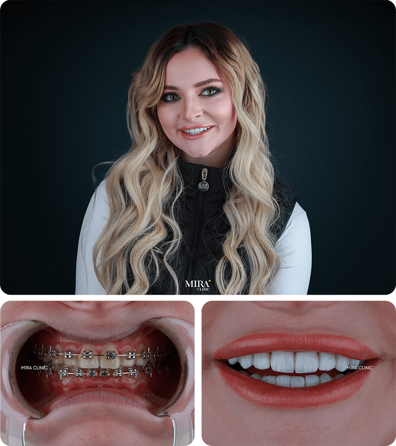 Преображение 5