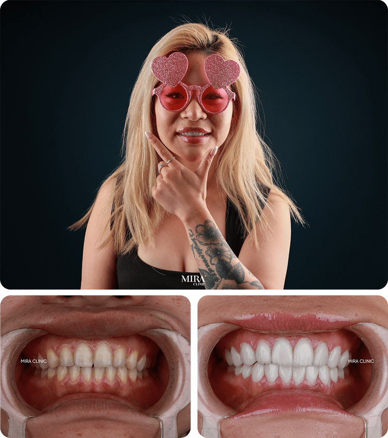 Преображение 6