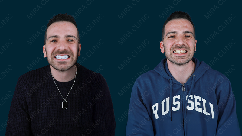 hollywood smile real review