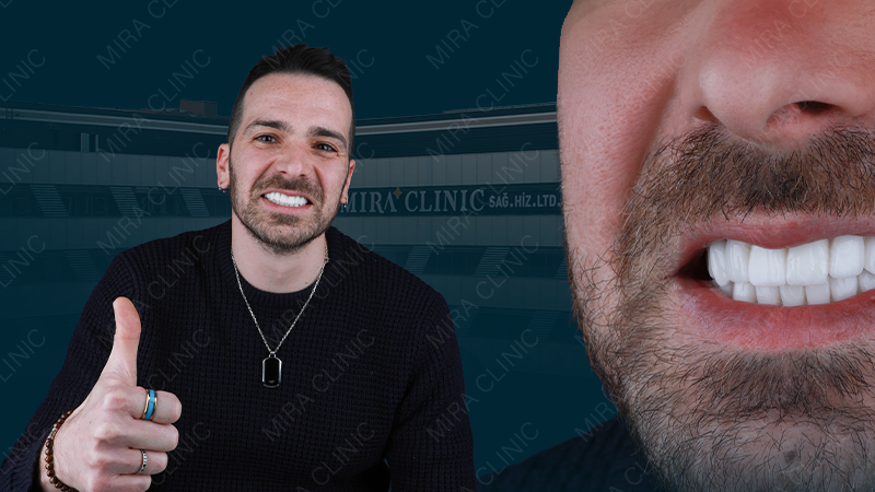 هوليوود سمايل تجارب المرضى 