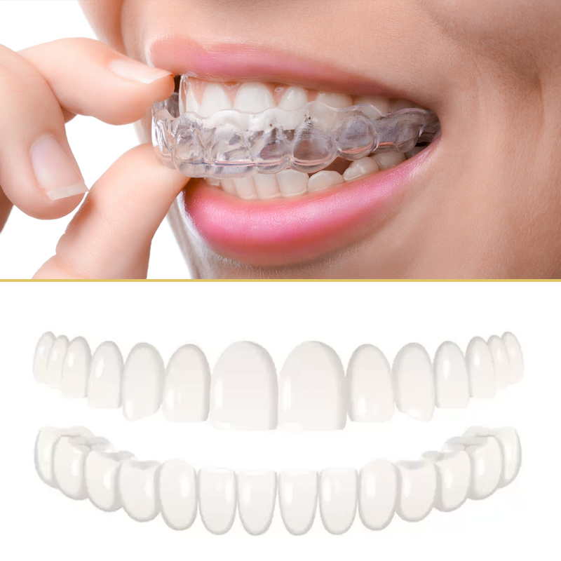 How to close a gap in your teeth without braces? | Mira Clinic