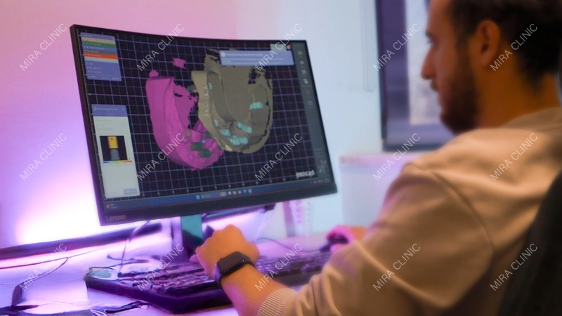 CAD/CAM