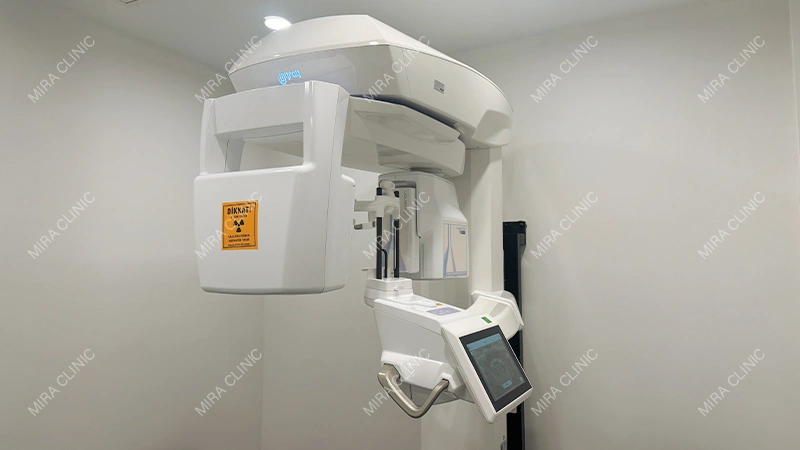 CBCT