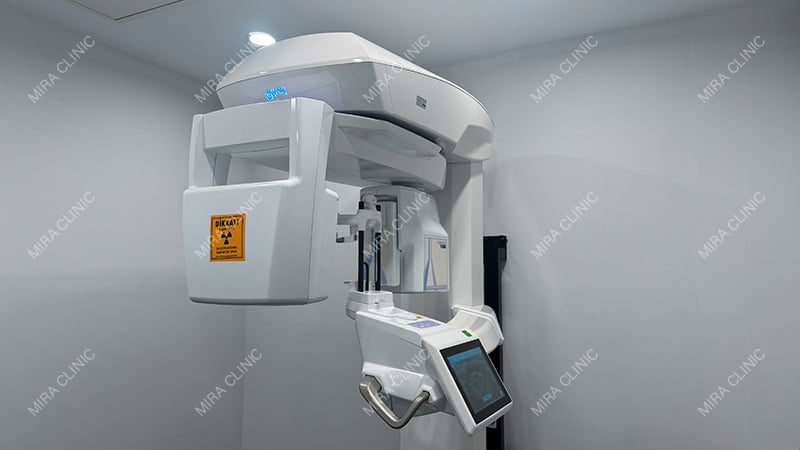 CBCT