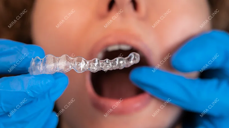 Retainers