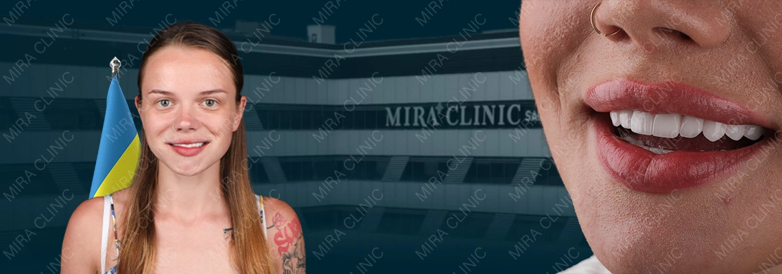 Hollywood Smile в Стамбуле: отзыв пациента и полный путь лечения