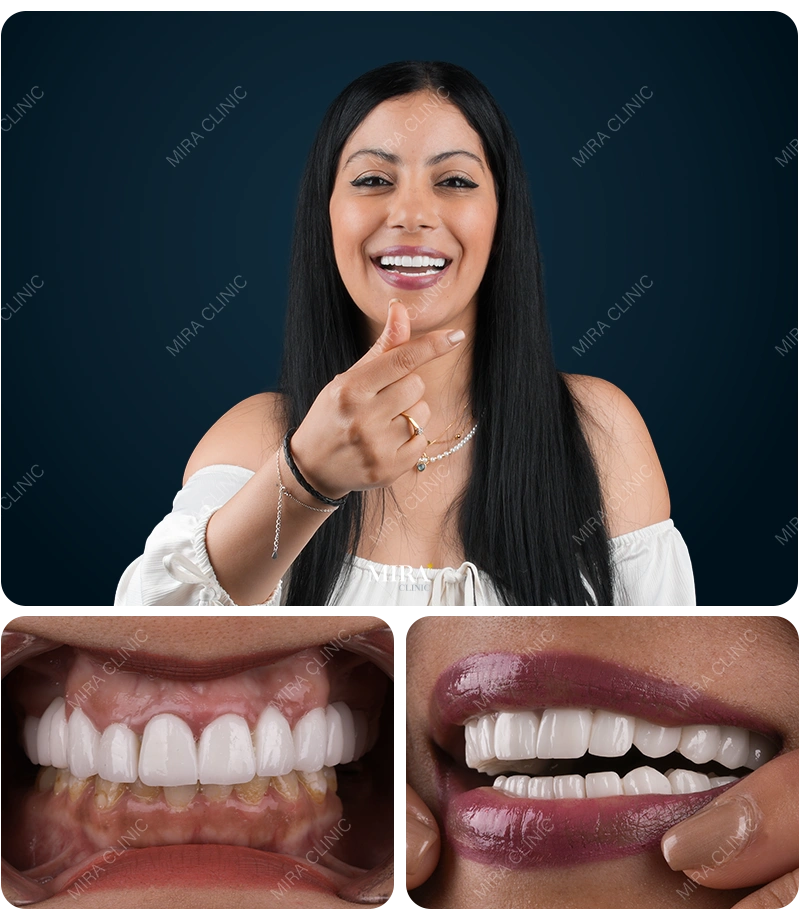 Before&After