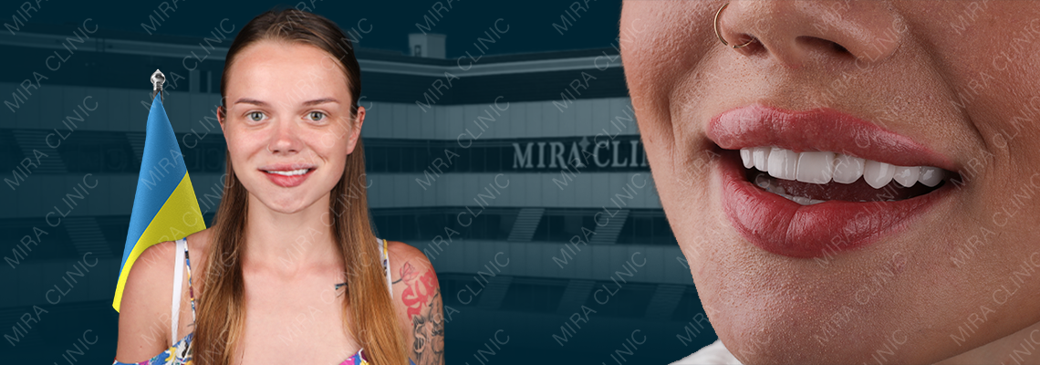 Avis d’une patiente Hollywood Smile de l’Ukraine à Istanbul