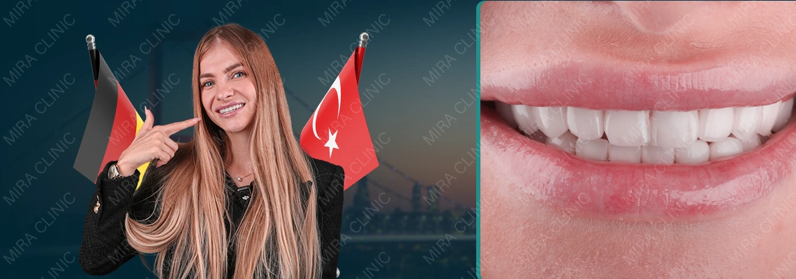 تجارب ابتسامة هوليود في تركيا – قصة دانيلا بوركا الحقيقية من ألمانيا إلى إسطنبول