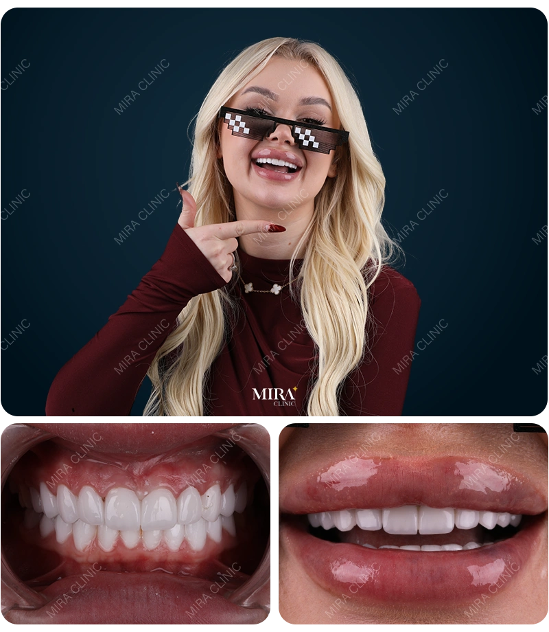 Before&After