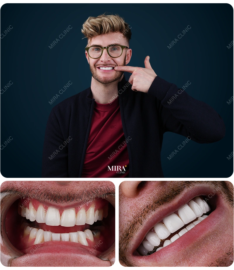 Before&After