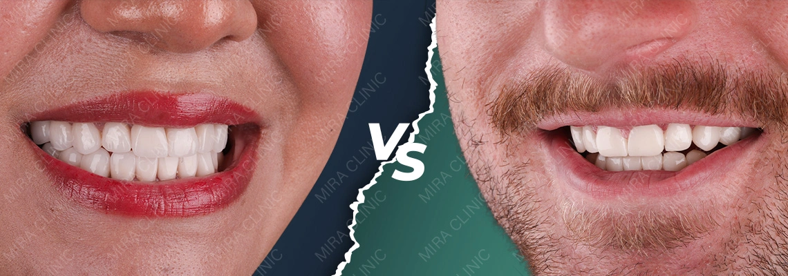 E-max vs Zircone : Comparaison Clinique 2026