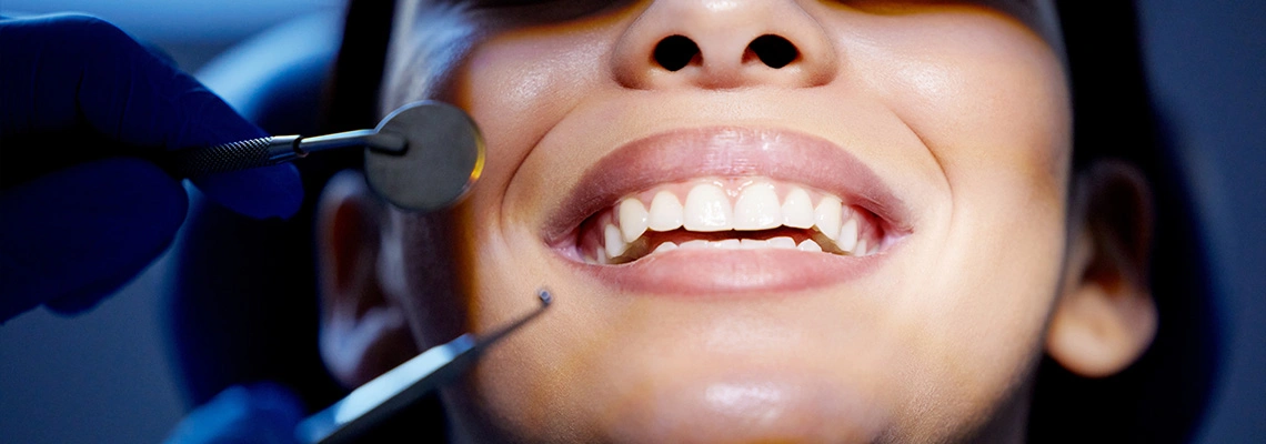 تجميل الابتسامة في تركيا: دليل شامل للحصول على ابتسامة هوليود في 7 أيام