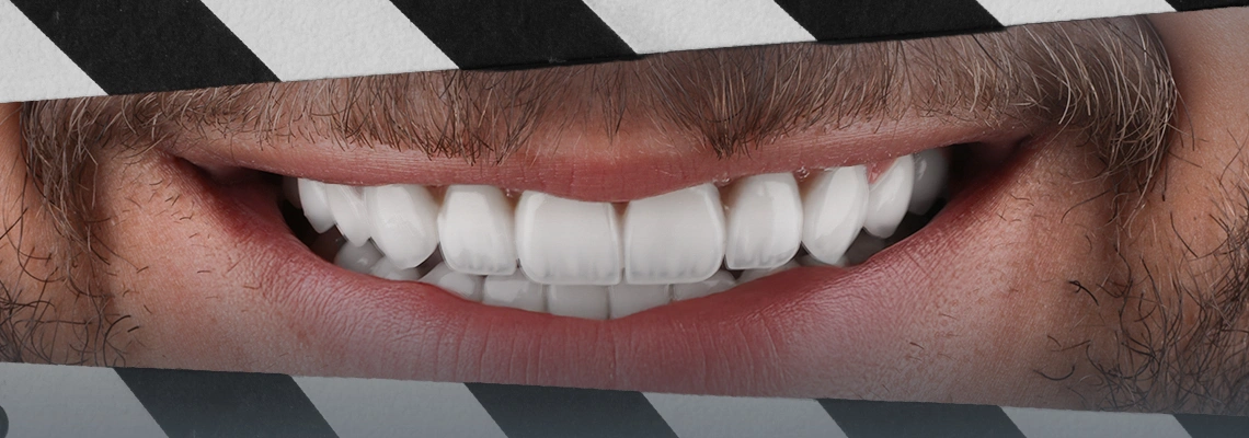 La psychologie du sourire Hollywoodien en Turquie : Confiance en soi, rencontres et opportunités professionnelles expliquées