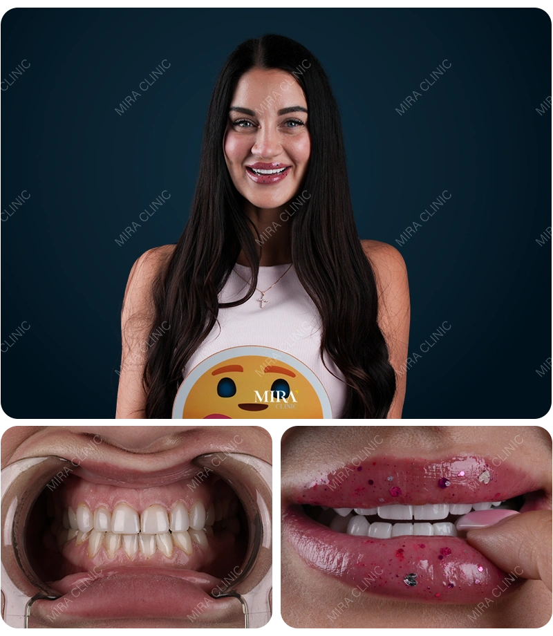 Before&After