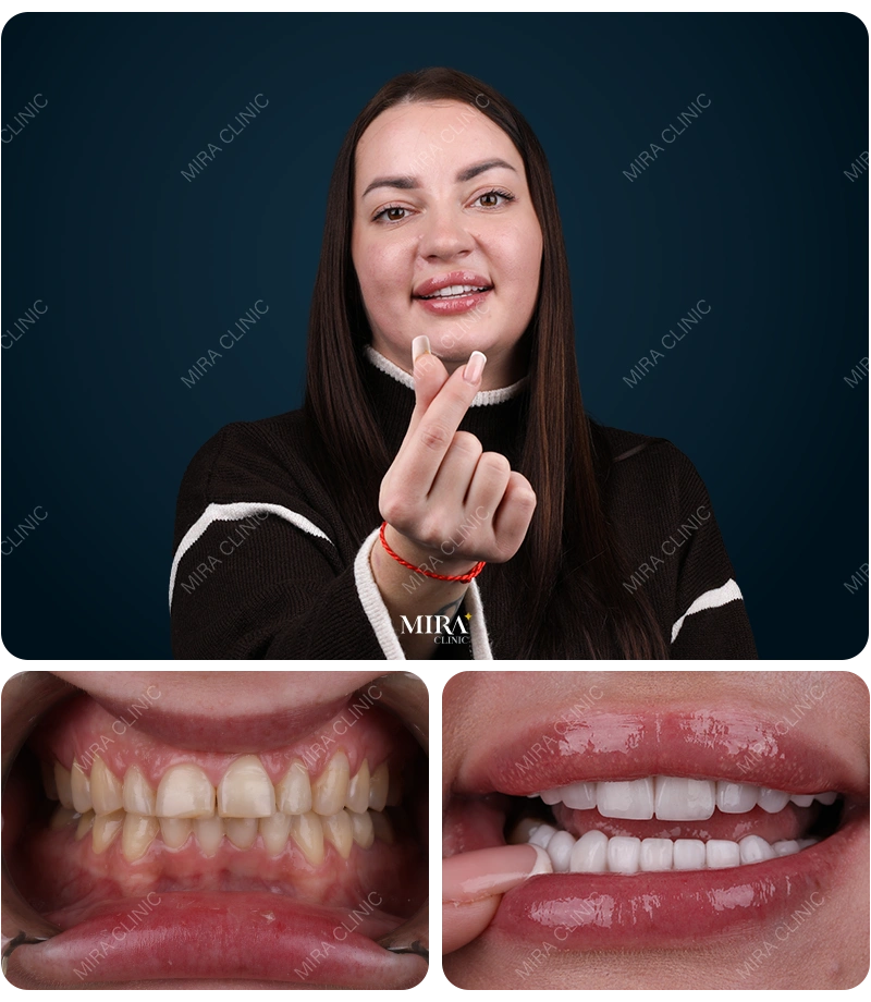 Before&After