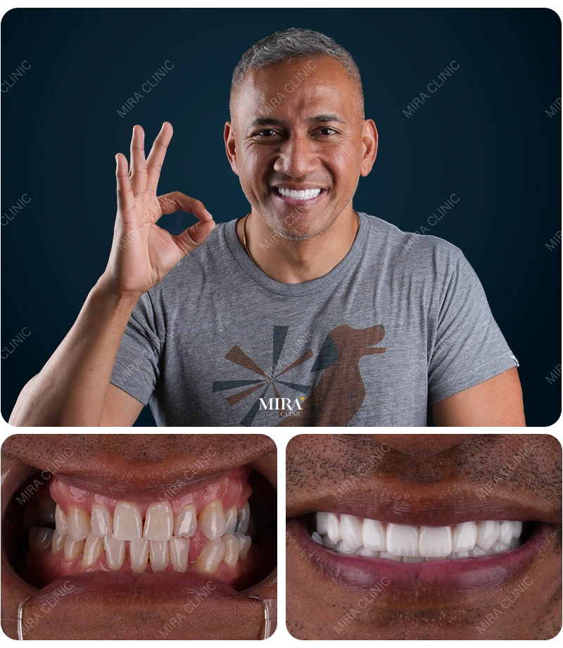 Before&After