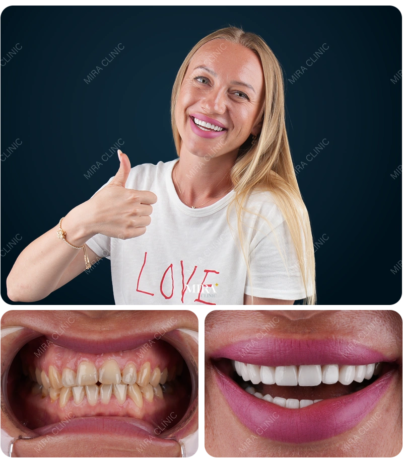 Before&After