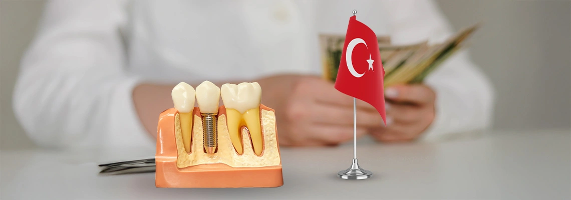Dental Implants in Turkey – Cost, Procedure, Packages and Real Patient Results (2026 Guide)