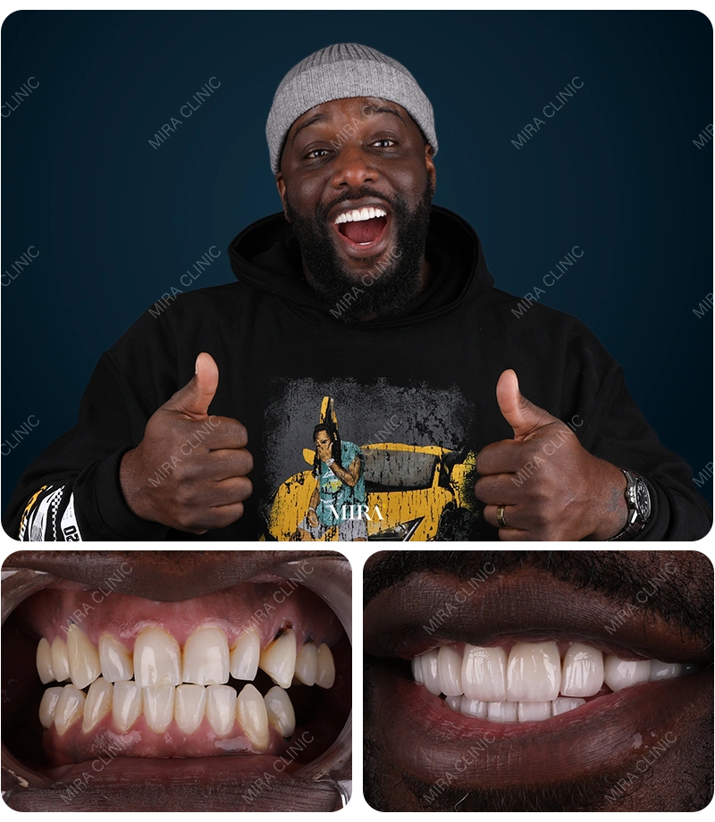 Before&After