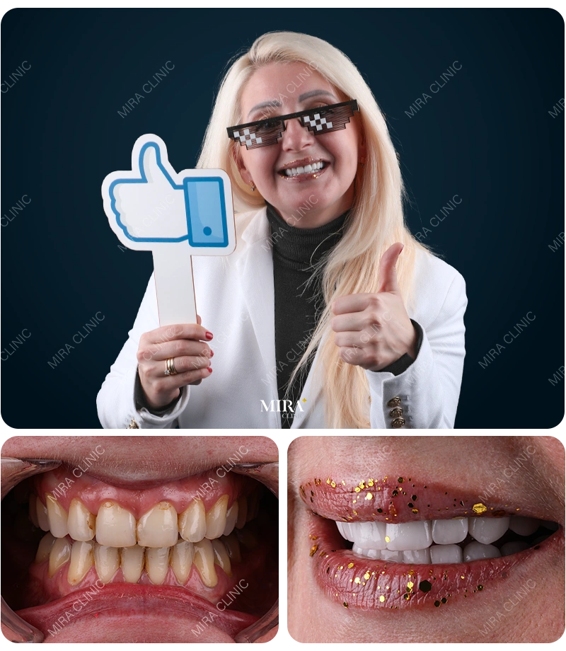 Before&After