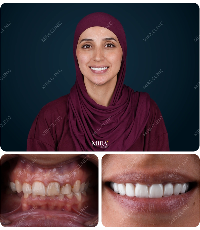 Before&After