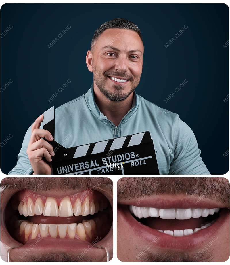 Before&After
