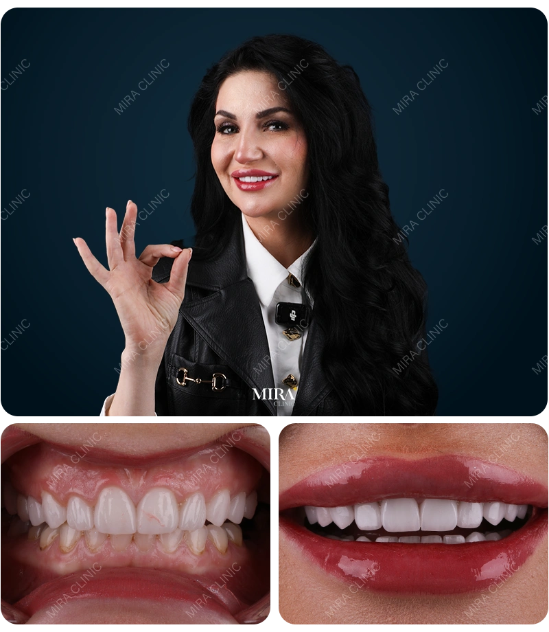Before&After