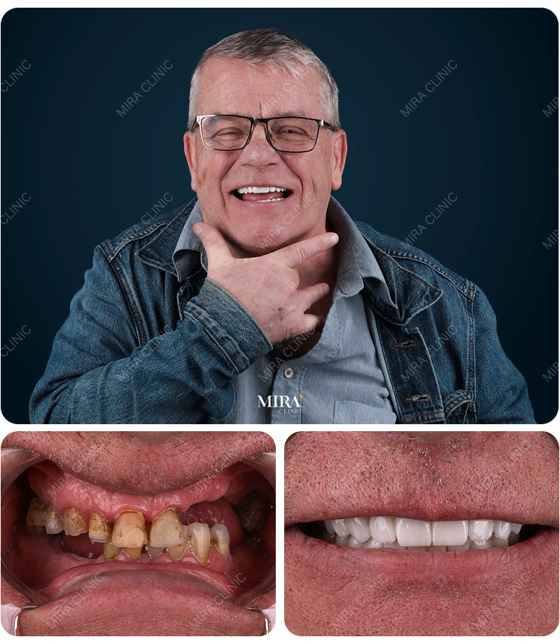 Before&After