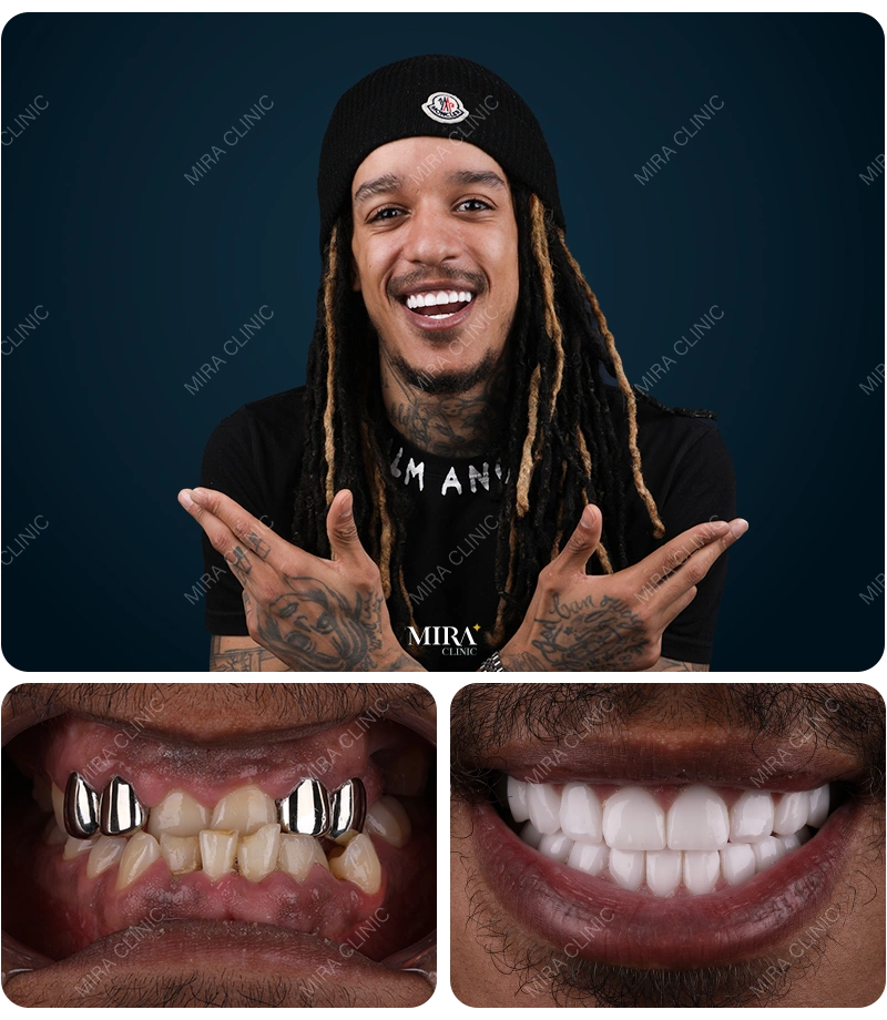 Before&After