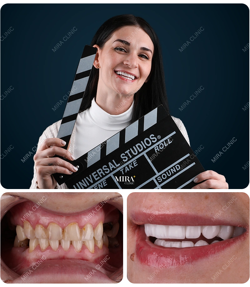 Before&After