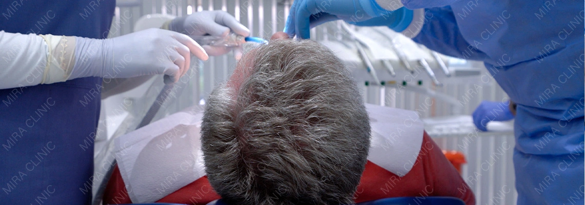 Les facettes dentaires sont-elles réversibles ? Que se passe-t-il si vous changez d’avis plus tard ?