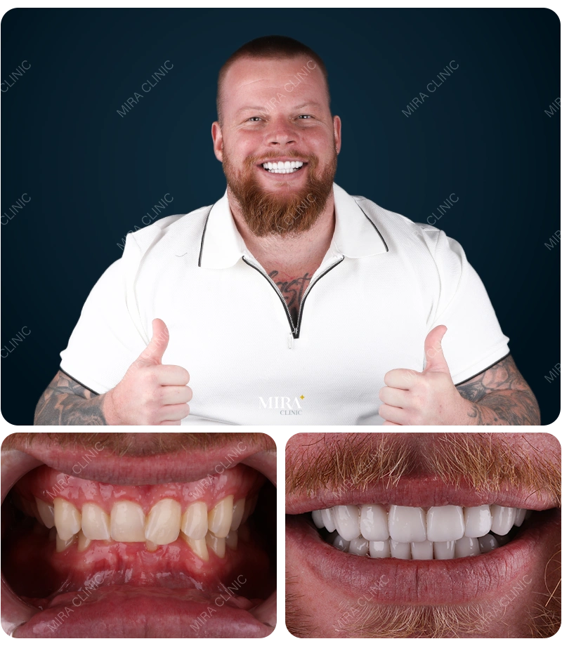 Before&After