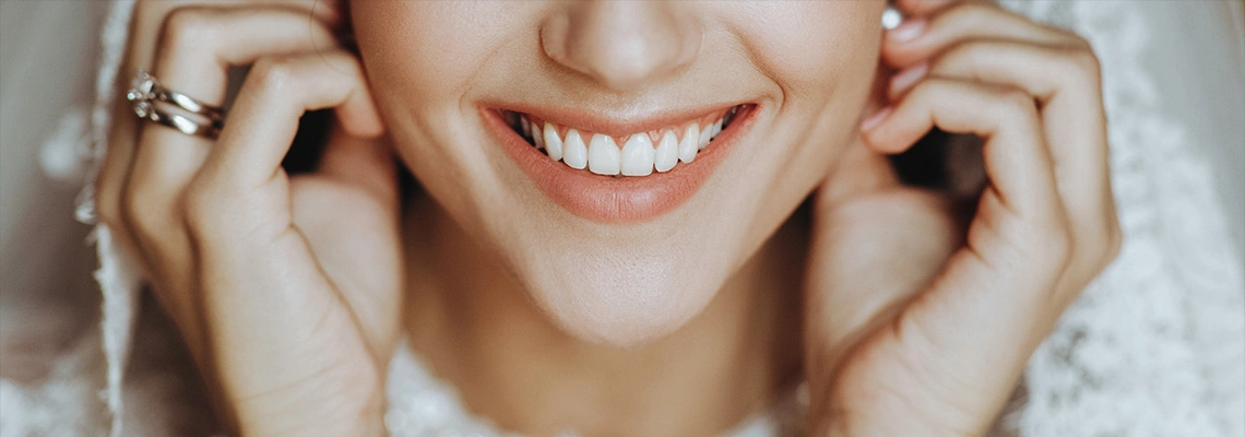 ابتسامة العروسين في تركيا… رحلة واحدة لابتسامتين مثاليتين