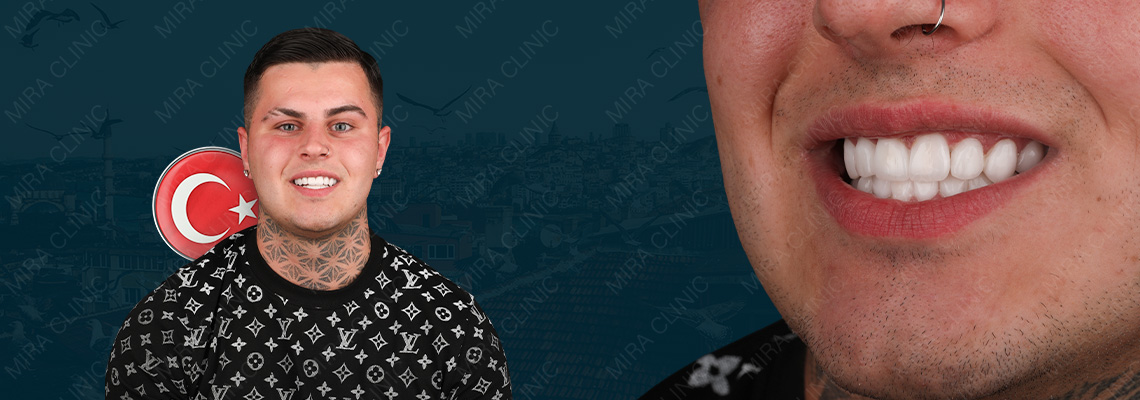 Как один пациент изменил свою улыбку благодаря Hollywood Smile — отзыв Джейми