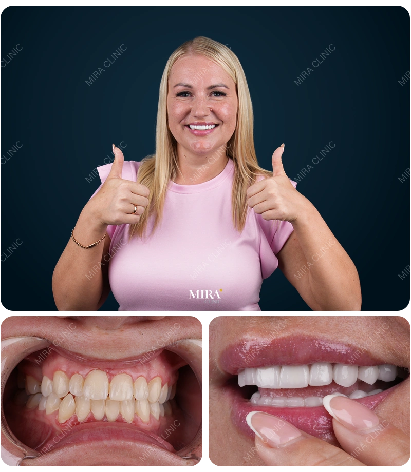 Before&After