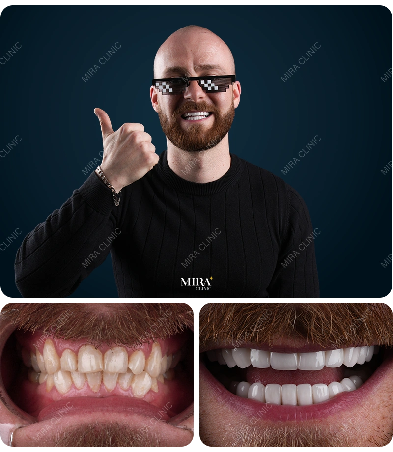Before&After