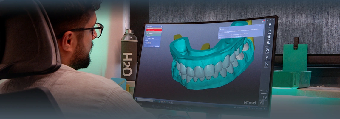 Digital Smile Design (DSD) in Turkey: Preview Your New Smile Before Treatment