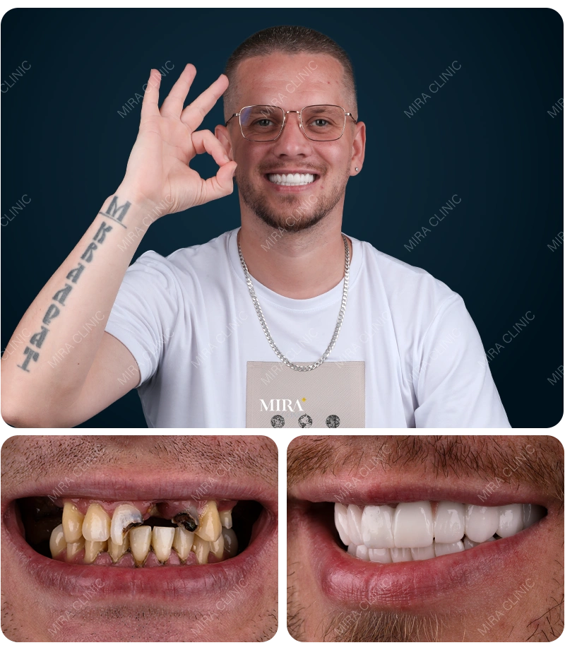 Before&After
