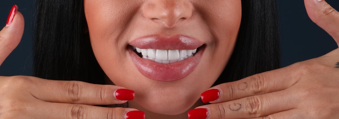 Hollywood Smile en Turquie : Techniques Avancées et Prix Abordables en 2025