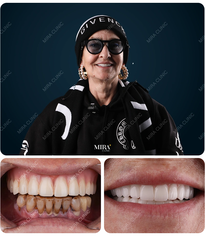 Before&After