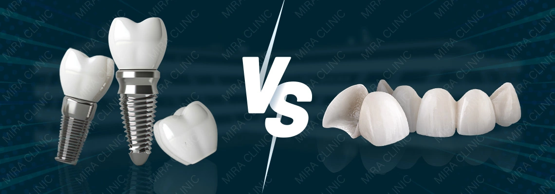 Turkey Teeth vs Veneers (2026): What Clinics Really Do in Turkey, the Crown-Vs-Veneer Reality, and the Safe Prep Ladder