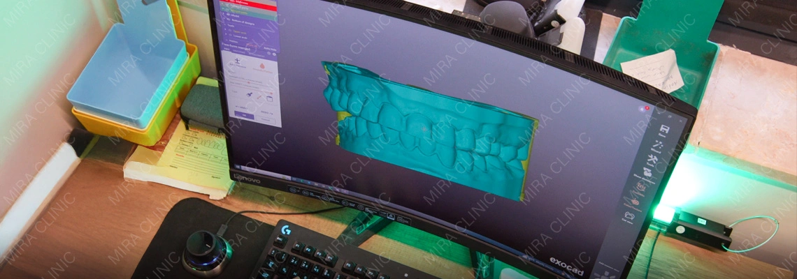 تصميم الابتسامة الرقمي لابتسامة هوليوود في تركيا: ماذا يرى المريض قبل العلاج