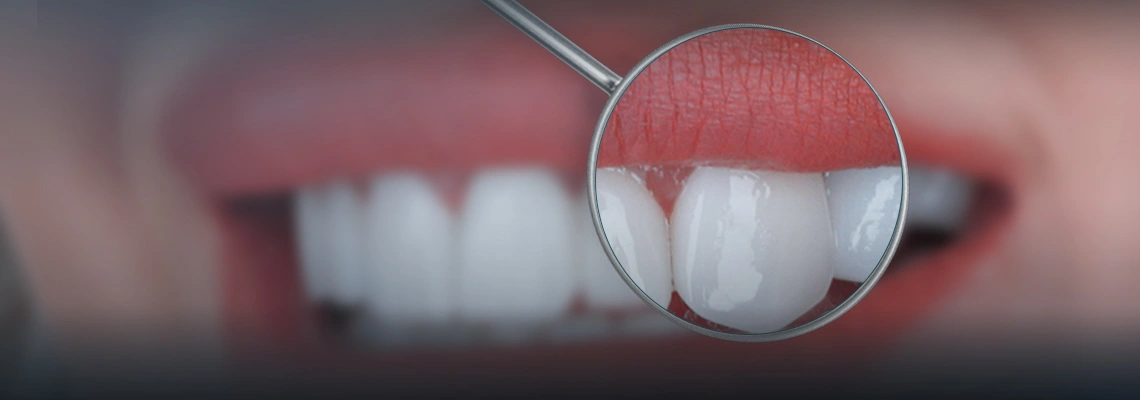 Smile Makeover in Turkey: What to Expect in Just 7 Days (Full Itinerary)