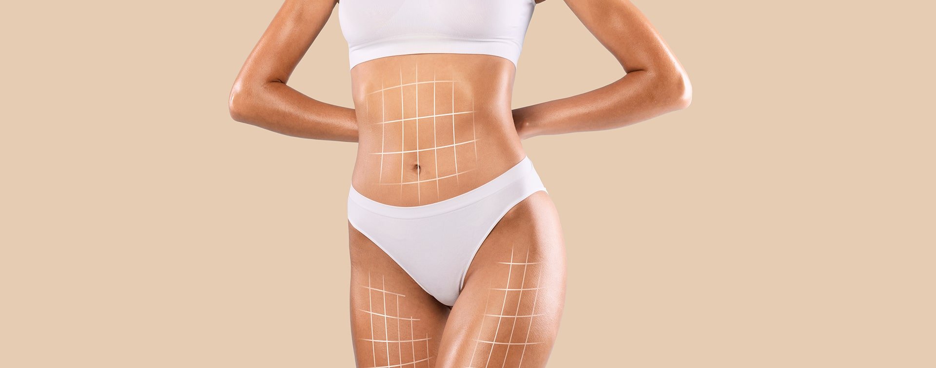 Mira-clinic  Tummy tuck recovery: recovery stages, post-operative  instructions, and side effects.