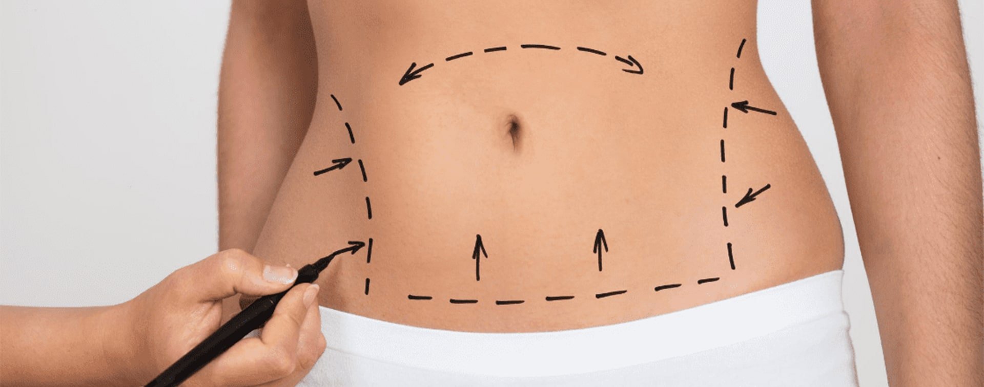 Abdominoplastie en Turquie