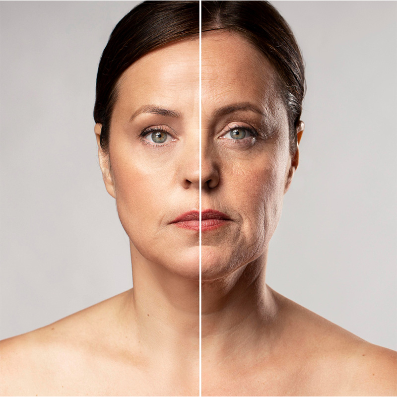 Injection de Botox pour le visage: Avantages et effets secondaires